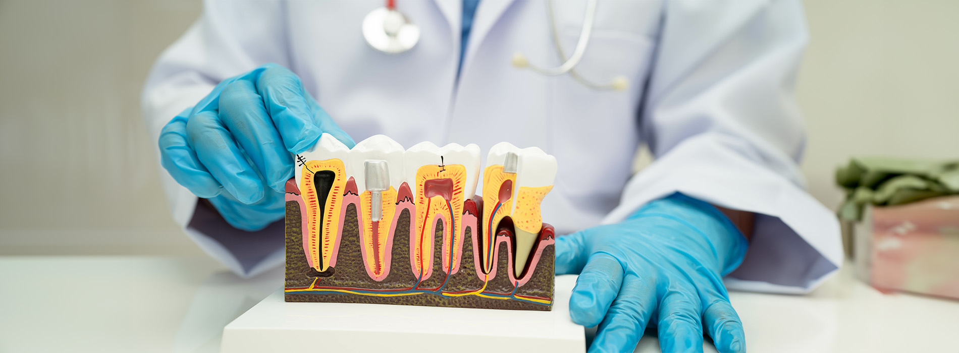 5th Avenue Dentistry and Implants P.L.L.C. | Teeth Whitening, Implant Dentistry and Digital Radiography