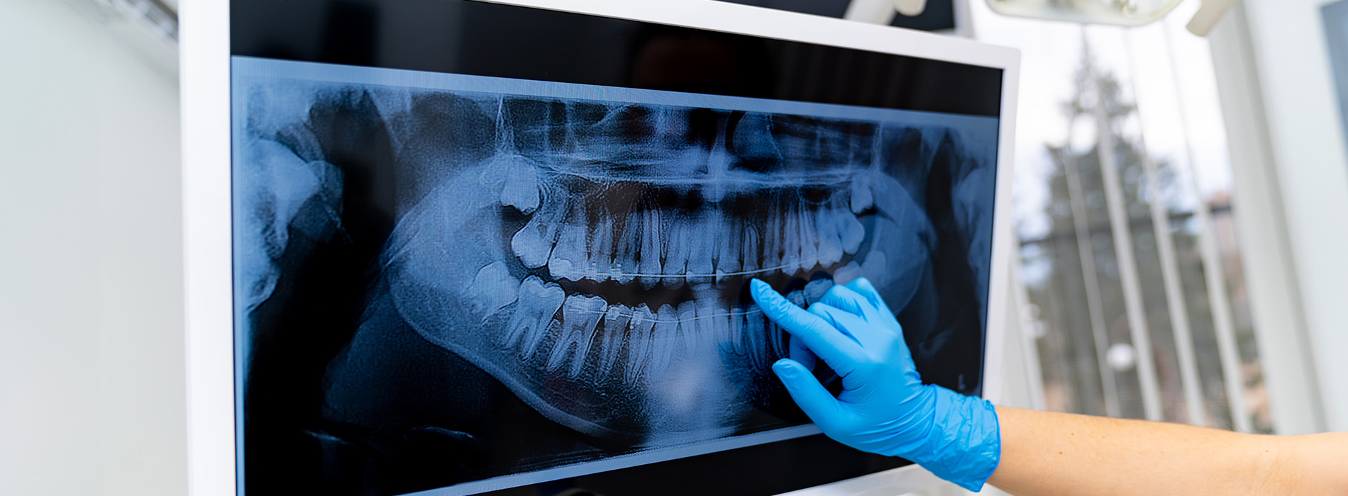 5th Avenue Dentistry and Implants P.L.L.C. | Operating Microscopes, All-on-6 reg  and Dental Cleanings