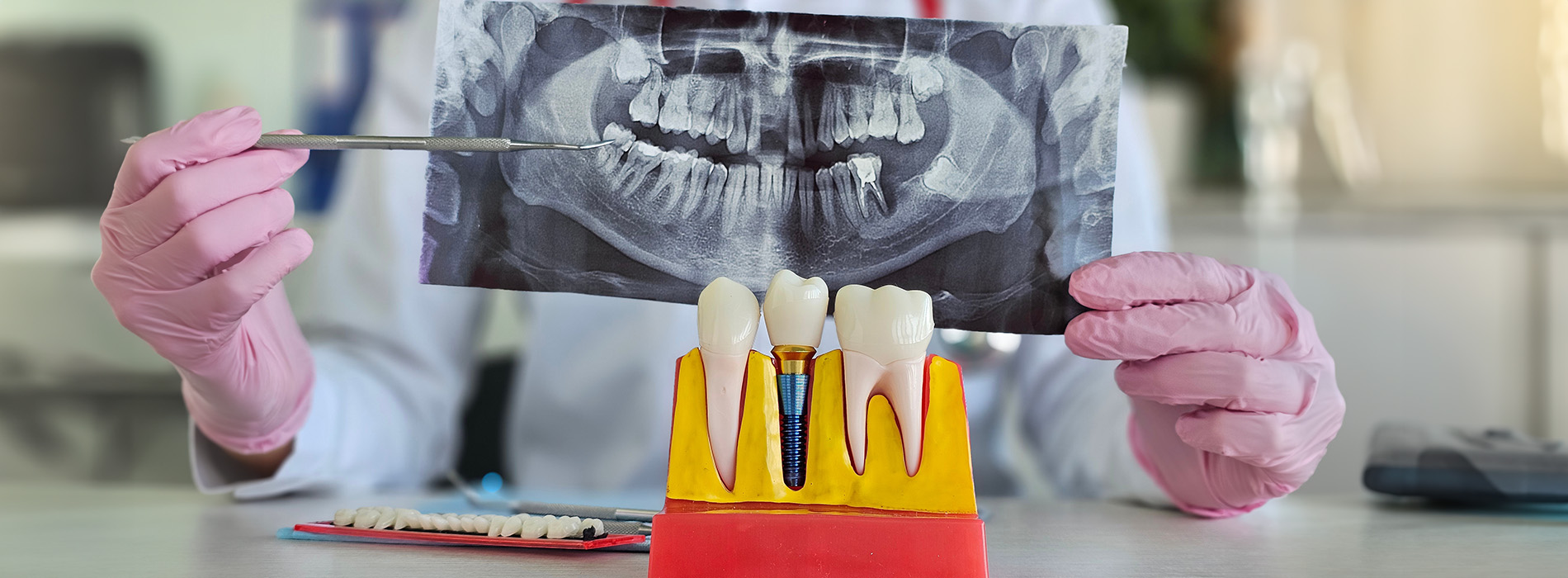 5th Avenue Dentistry and Implants P.L.L.C. | Root Canals, Night Guards and Intraoral Camera