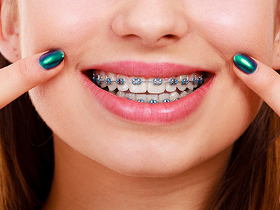 5th Avenue Dentistry and Implants P.L.L.C. | Oral Exams, CEREC and Intraoral Camera