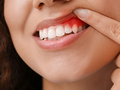 5th Avenue Dentistry and Implants P.L.L.C. | Oral Exams, Cosmetic Dentistry and Sleep Apnea