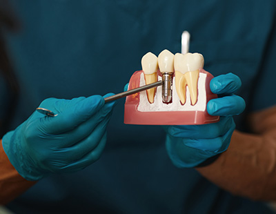 5th Avenue Dentistry and Implants P.L.L.C. | ZOOM  Whitening, Night Guards and Oral Exams