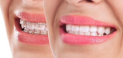 5th Avenue Dentistry and Implants P.L.L.C. | Oral Exams, CEREC and Intraoral Camera
