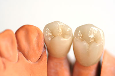 5th Avenue Dentistry and Implants P.L.L.C. | Cosmetic Dentistry, Preventative Program and Root Canals