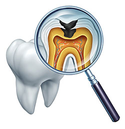 5th Avenue Dentistry and Implants P.L.L.C. | Snoring Appliances, ZOOM  Whitening and Teeth Whitening