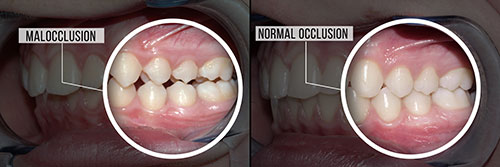 5th Avenue Dentistry and Implants P.L.L.C. | Operating Microscopes, Full Mouth Reconstruction and CEREC