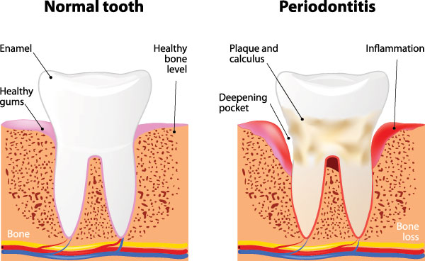5th Avenue Dentistry and Implants P.L.L.C. | Night Guards, Inlays  amp  Onlays and Digital Radiography