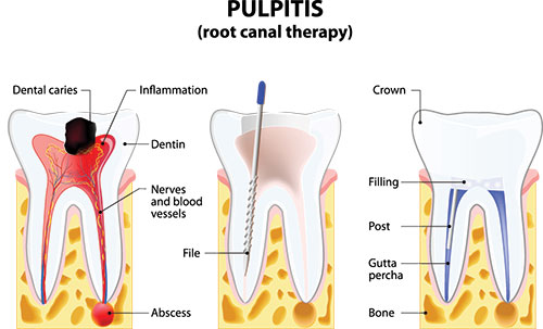 5th Avenue Dentistry and Implants P.L.L.C. | Night Guards, Teeth Whitening and Dental Cleanings