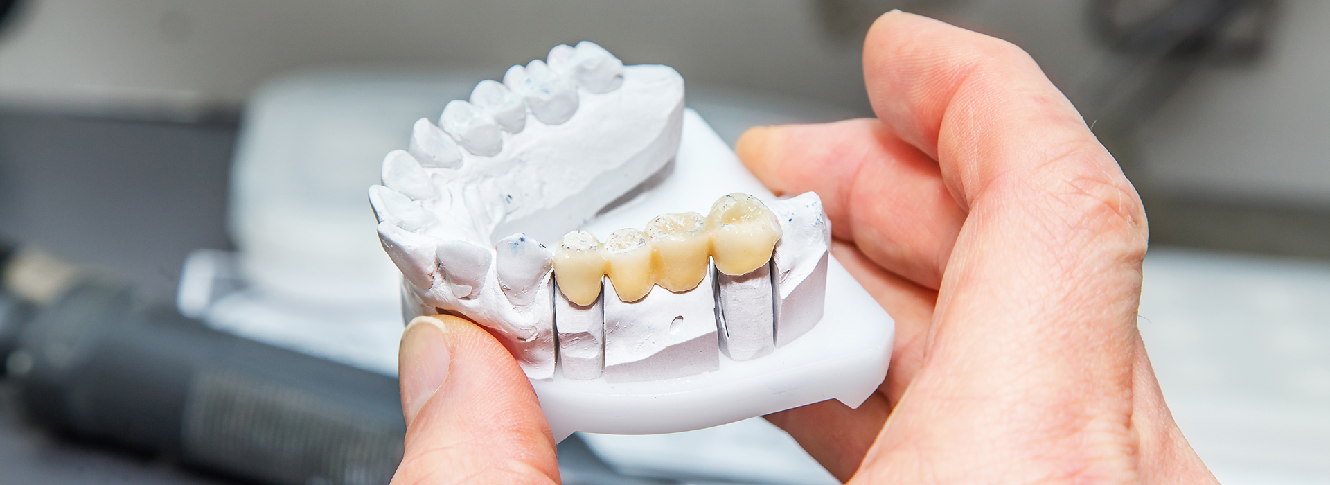 5th Avenue Dentistry and Implants P.L.L.C. | Implant Restorations, Oral Surgery and All-on-6 reg 
