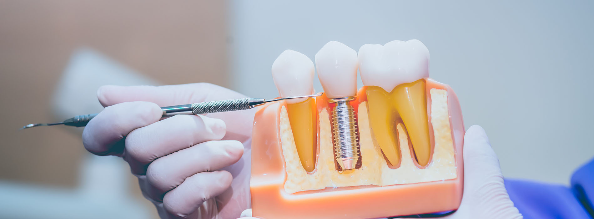 5th Avenue Dentistry and Implants P.L.L.C. | Digital Radiography, LANAP reg  and Digital Impressions