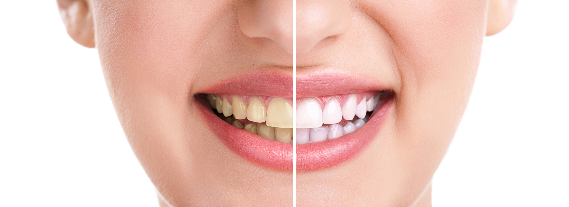 5th Avenue Dentistry and Implants P.L.L.C. | All-on-4 reg , CEREC and Extractions