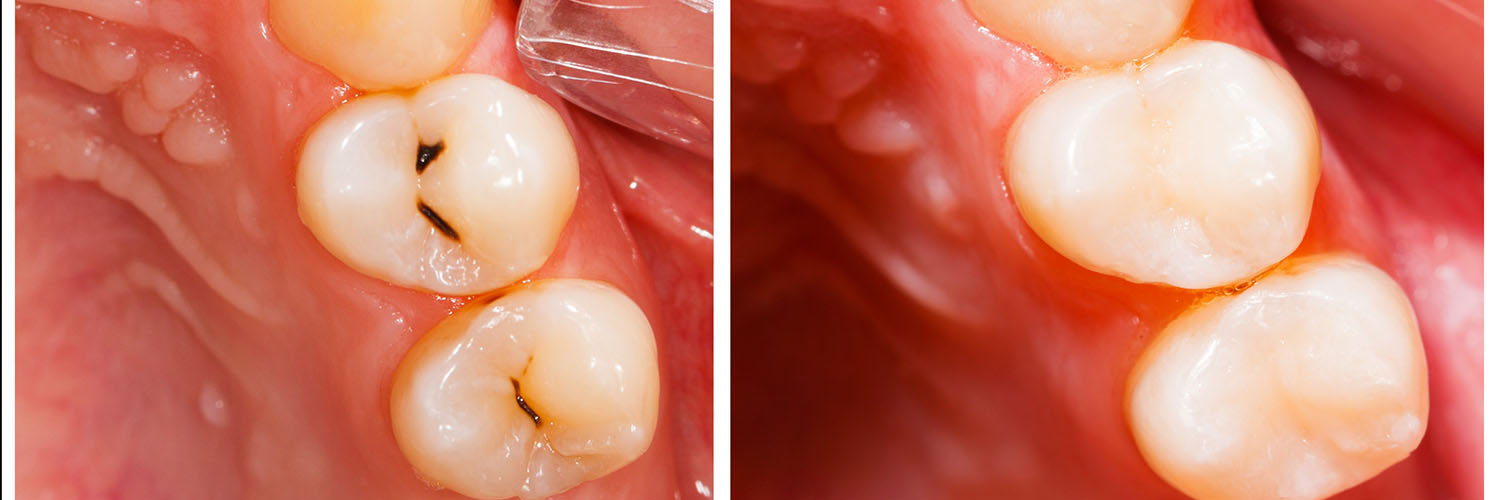 5th Avenue Dentistry and Implants