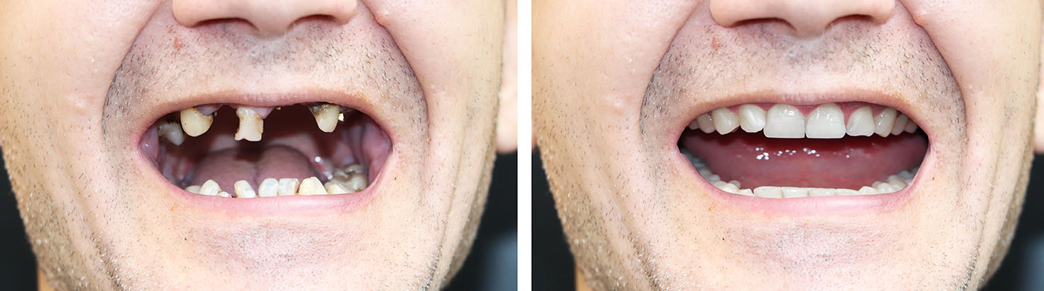 5th Avenue Dentistry and Implants