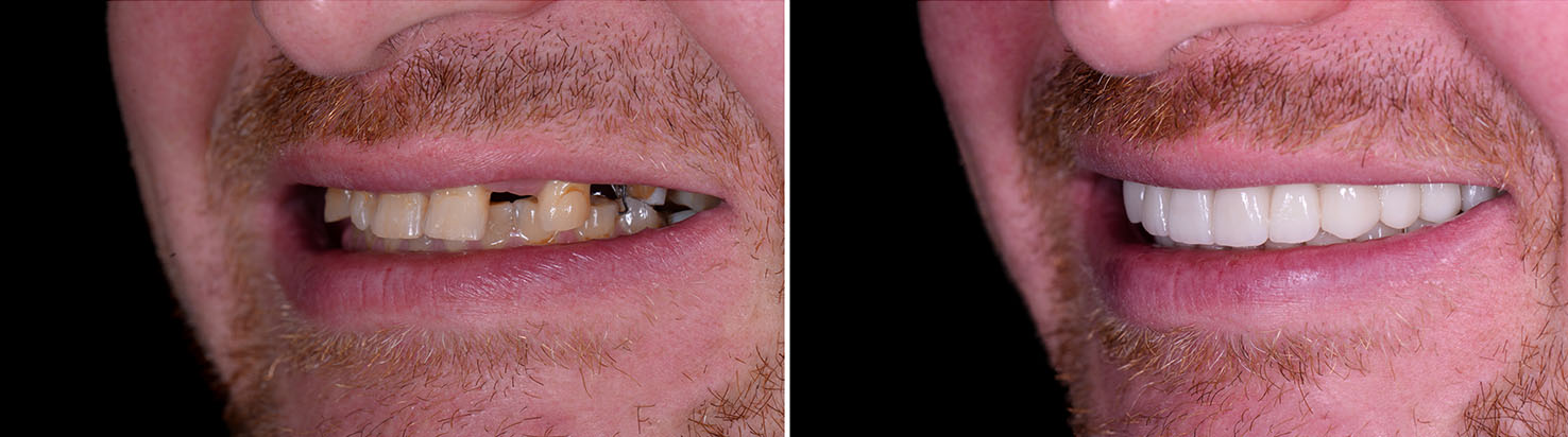 5th Avenue Dentistry and Implants